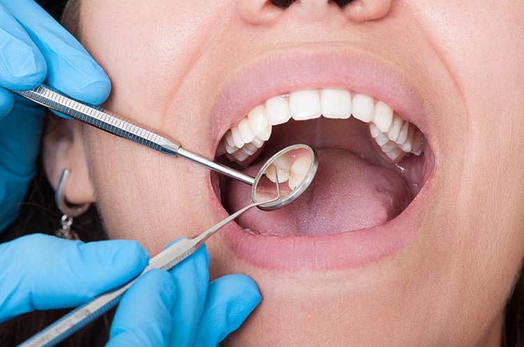 اقدامات لازم پس از کشیدن دندان