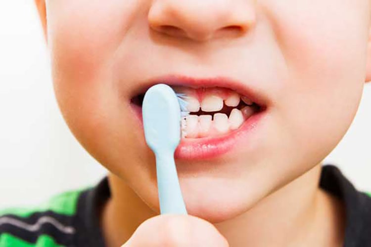 علل پوسیدگی دندان در کودکان
