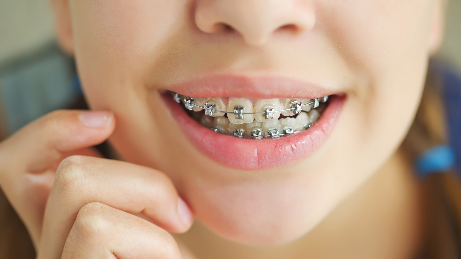 چه کسانی نیاز به ارتودنسی دندان و فک دارند؟